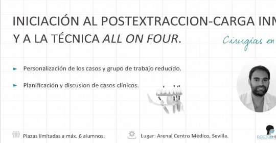 Curso implantes dentales y técnica «All on four» impartido por el Dr Herce