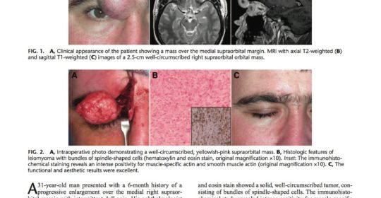 Nuevo artículo de investigación del Dr. Herce